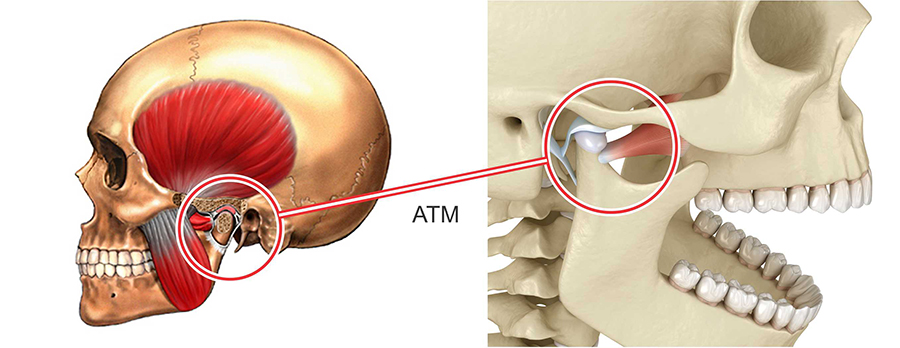 O que é Disfunção Temporomandibular? - Mega Imagem